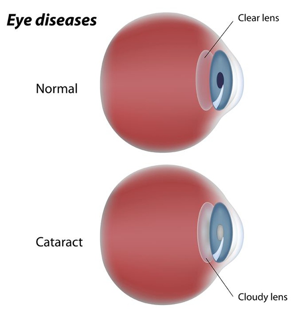 Las Cruces Eye Doctor